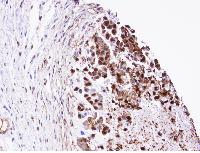 Immunohistochemistry (Formalin/PFA-fixed paraffin-embedded sections) - Anti-Triosephosphate isomerase antibody (AB96696), expandable thumbnail