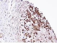Immunohistochemistry (Formalin/PFA-fixed paraffin-embedded sections) - Anti-Triosephosphate isomerase antibody (AB96696)