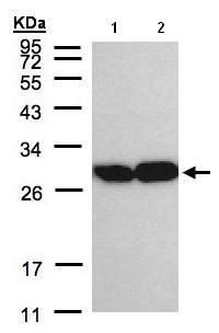 Western blot - Anti-Triosephosphate isomerase antibody (AB96696), expandable thumbnail