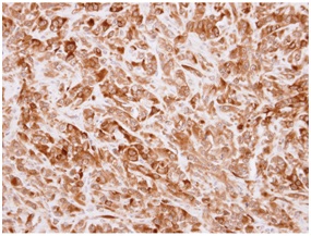 Immunohistochemistry (Formalin/PFA-fixed paraffin-embedded sections) - Anti-TRIP antibody (AB151307)