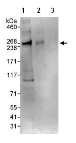 Western blot - Anti-TRIP12/ULF antibody (AB86220)