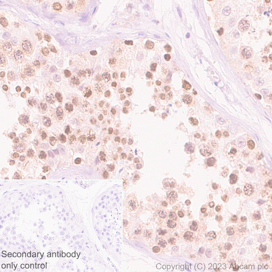 Immunohistochemistry (Formalin/PFA-fixed paraffin-embedded sections) - Anti-TRIP12/ULF antibody [EPR27062-86] - BSA and Azide free (ab313629), expandable thumbnail
