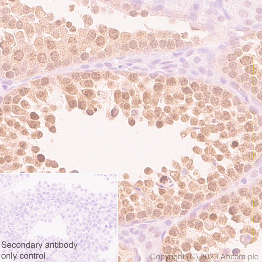 Immunohistochemistry (Formalin/PFA-fixed paraffin-embedded sections) - Anti-TRIP12/ULF antibody [EPR27062-86] - BSA and Azide free (ab313629), expandable thumbnail