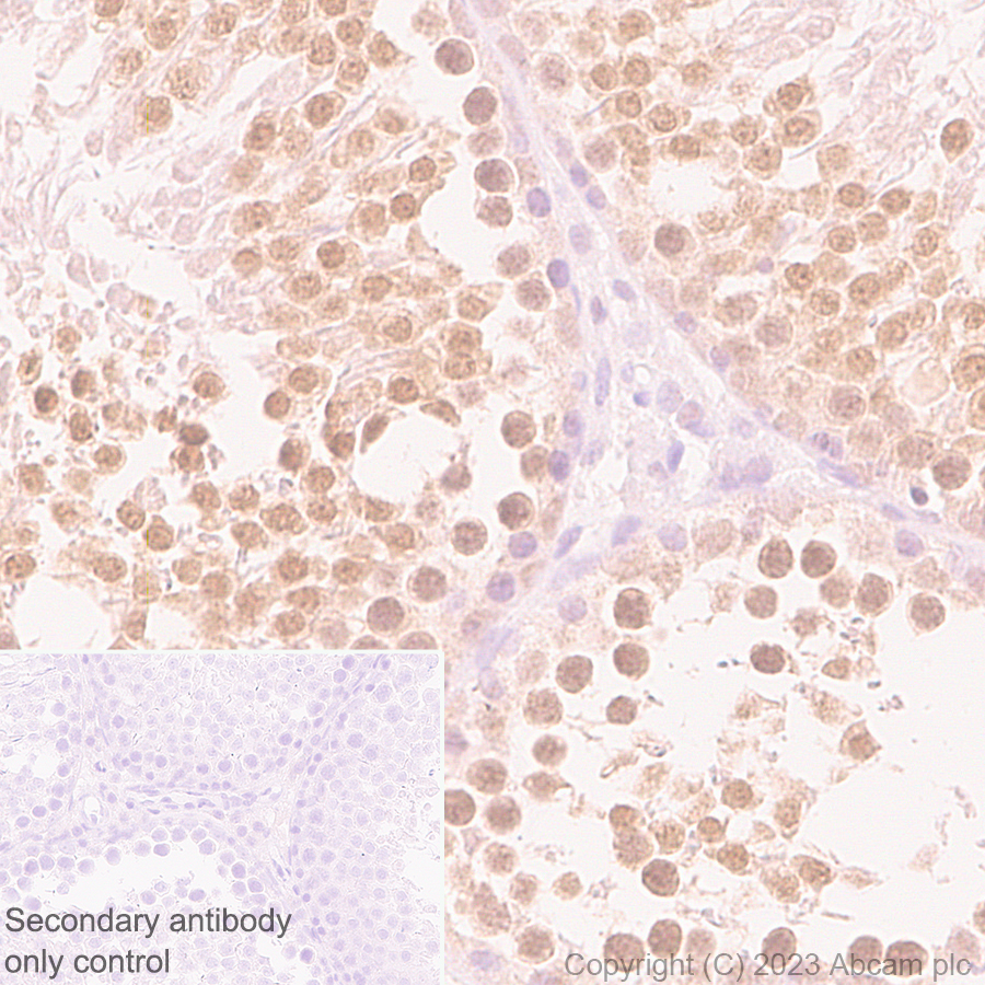 Immunohistochemistry (Formalin/PFA-fixed paraffin-embedded sections) - Anti-TRIP12/ULF antibody [EPR27062-86] - BSA and Azide free (ab313629), expandable thumbnail