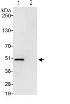 Immunoprecipitation - Anti-TRIP13/PCH2 antibody (AB128171)