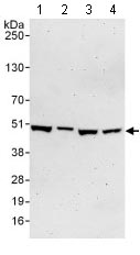 Western blot - Anti-TRIP13/PCH2 antibody (AB128171)