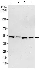 Western blot - Anti-TRIP13/PCH2 antibody (AB128171)