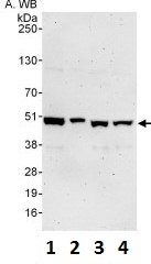 Western blot - Anti-TRIP13/PCH2 antibody (AB128187)