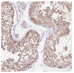 Immunohistochemistry (Formalin/PFA-fixed paraffin-embedded sections) - Anti-TRIP13/PCH2 antibody (AB204331)