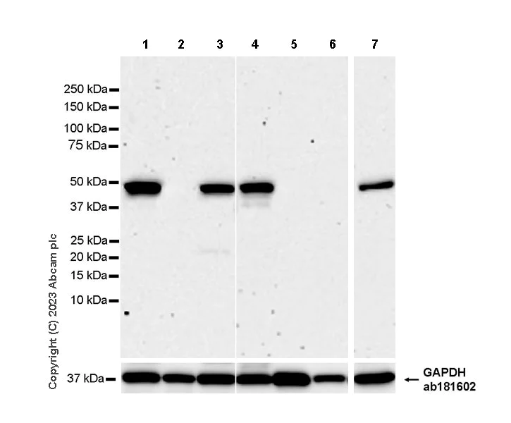 Western blot - Anti-TRIP13/PCH2 antibody [EPR27063-80] - BSA and Azide free (AB313703)