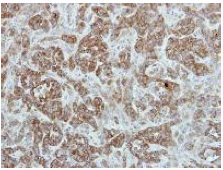 Immunohistochemistry (Formalin/PFA-fixed paraffin-embedded sections) - Anti-TRIP6 antibody (AB137478), expandable thumbnail