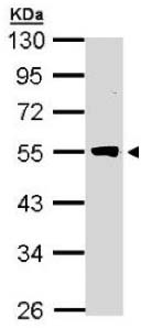 Western blot - Anti-TRIP6 antibody (AB137478), expandable thumbnail