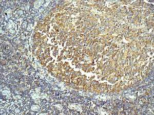 Immunohistochemistry (Formalin/PFA-fixed paraffin-embedded sections) - Anti-Tripeptidyl peptidase II/TPPII antibody [EPR13202] (AB180177)