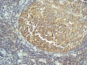 Immunohistochemistry (Formalin/PFA-fixed paraffin-embedded sections) - Anti-Tripeptidyl peptidase II/TPPII antibody [EPR13202] - BSA and Azide free (AB250179), expandable thumbnail