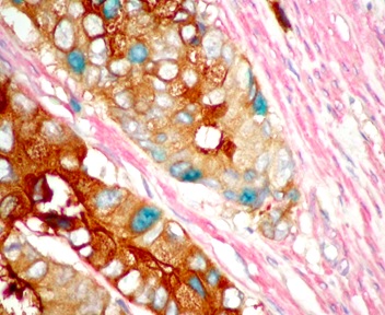 Immunohistochemistry paraffin embedded sections - TripleStain IHC Kit: M&M&R on Human tissue (DAB, AP/Red & HRP/Green) (AB183286)