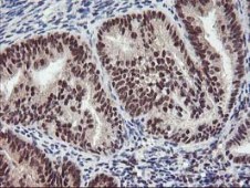 Immunohistochemistry (Formalin/PFA-fixed paraffin-embedded sections) - Anti-Tristetraprolin/TTP antibody [OTI1A2] (ab119779), expandable thumbnail