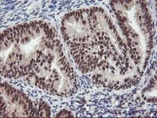 Immunohistochemistry (Formalin/PFA-fixed paraffin-embedded sections) - Anti-Tristetraprolin/TTP antibody [OTI1A2] (AB119779)