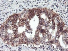 Immunohistochemistry (Formalin/PFA-fixed paraffin-embedded sections) - Anti-Tristetraprolin/TTP antibody [OTI1A2] (ab119779), expandable thumbnail