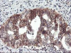 Immunohistochemistry (Formalin/PFA-fixed paraffin-embedded sections) - Anti-Tristetraprolin/TTP antibody [OTI1A2] (AB119779)