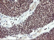 Immunohistochemistry (Formalin/PFA-fixed paraffin-embedded sections) - Anti-Tristetraprolin/TTP antibody [OTI1A2] (ab119779), expandable thumbnail