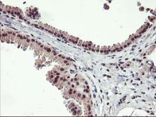 Immunohistochemistry (Formalin/PFA-fixed paraffin-embedded sections) - Anti-Tristetraprolin/TTP antibody [OTI1A2] (ab119779), expandable thumbnail