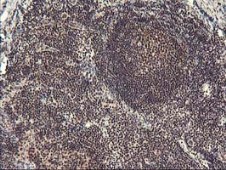Immunohistochemistry (Formalin/PFA-fixed paraffin-embedded sections) - Anti-Tristetraprolin/TTP antibody [OTI1A2] (ab119779), expandable thumbnail