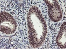 Immunohistochemistry (Formalin/PFA-fixed paraffin-embedded sections) - Anti-Tristetraprolin/TTP antibody [OTI1A2] (ab119779), expandable thumbnail