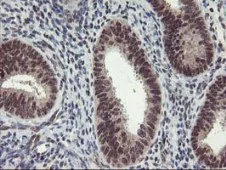 Immunohistochemistry (Formalin/PFA-fixed paraffin-embedded sections) - Anti-Tristetraprolin/TTP antibody [OTI1A2] (AB119779)