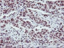 Immunohistochemistry (Formalin/PFA-fixed paraffin-embedded sections) - Anti-Tristetraprolin/TTP antibody [OTI1A2] (ab119779), expandable thumbnail