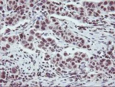 Immunohistochemistry (Formalin/PFA-fixed paraffin-embedded sections) - Anti-Tristetraprolin/TTP antibody [OTI1A2] (AB119779)