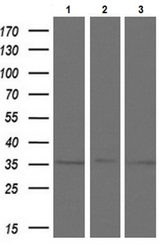 Western blot - Anti-Tristetraprolin/TTP antibody [OTI1A2] (AB119779), expandable thumbnail