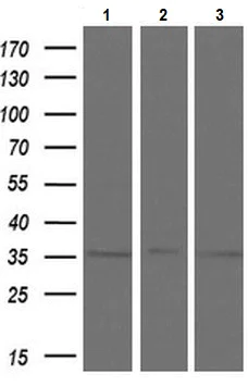 Western blot - Anti-Tristetraprolin/TTP antibody [OTI1A2] (AB119779)