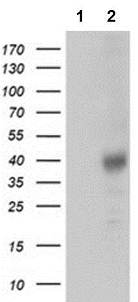 Western blot - Anti-Tristetraprolin/TTP antibody [OTI1A2] (AB119779), expandable thumbnail