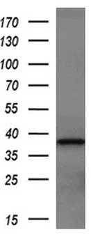 Western blot - Anti-Tristetraprolin/TTP antibody [OTI1A2] (AB119779)