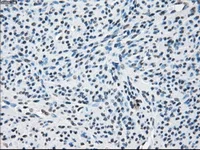 Immunohistochemistry (Formalin/PFA-fixed paraffin-embedded sections) - Anti-Tristetraprolin/TTP antibody [OTI8B5] (AB124024)