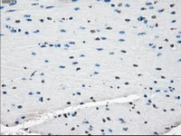 Immunohistochemistry (Formalin/PFA-fixed paraffin-embedded sections) - Anti-Tristetraprolin/TTP antibody [OTI8B5] (AB124024)