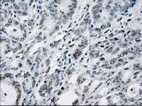 Immunohistochemistry (Formalin/PFA-fixed paraffin-embedded sections) - Anti-Tristetraprolin/TTP antibody [OTI8B5] (AB124024)