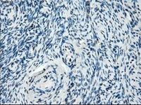 Immunohistochemistry (Formalin/PFA-fixed paraffin-embedded sections) - Anti-Tristetraprolin/TTP antibody [OTI8B5] (AB124024)