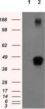 Western blot - Anti-Tristetraprolin/TTP antibody [OTI8B5] (AB124024)