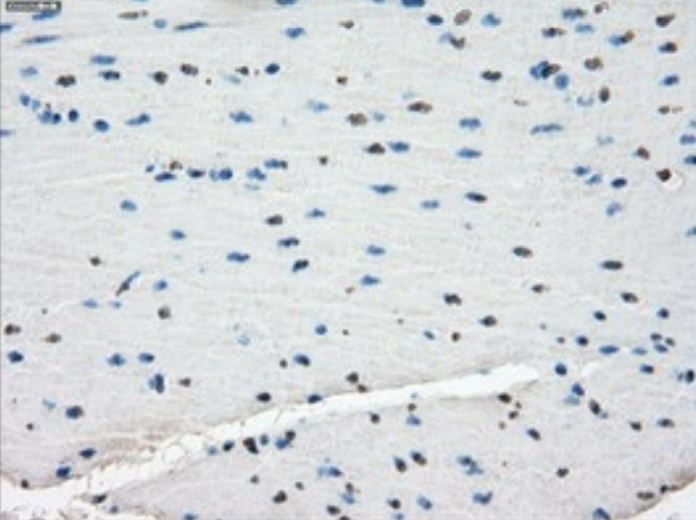 Immunohistochemistry (Formalin/PFA-fixed paraffin-embedded sections) - Anti-Tristetraprolin/TTP antibody [OTI8B5] - BSA and Azide free (AB273646), expandable thumbnail