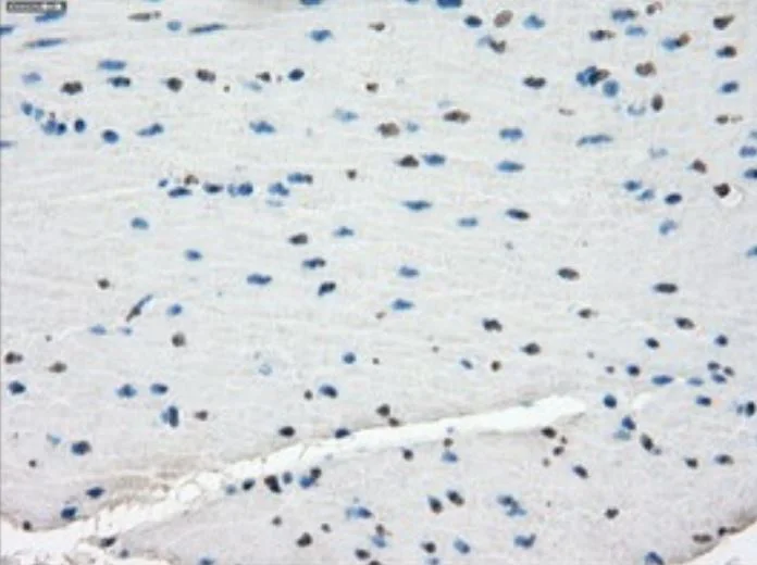 Immunohistochemistry (Formalin/PFA-fixed paraffin-embedded sections) - Anti-Tristetraprolin/TTP antibody [OTI8B5] - BSA and Azide free (AB273646)