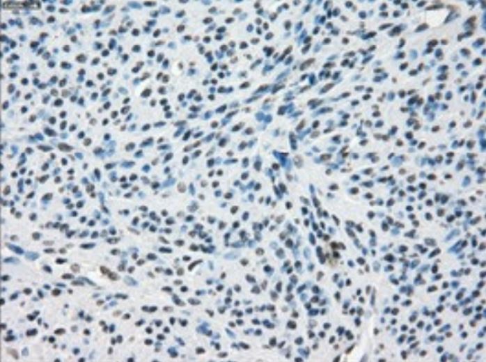 Immunohistochemistry (Formalin/PFA-fixed paraffin-embedded sections) - Anti-Tristetraprolin/TTP antibody [OTI8B5] - BSA and Azide free (ab273646), expandable thumbnail
