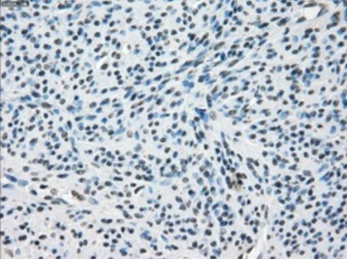 Immunohistochemistry (Formalin/PFA-fixed paraffin-embedded sections) - Anti-Tristetraprolin/TTP antibody [OTI8B5] - BSA and Azide free (AB273646)