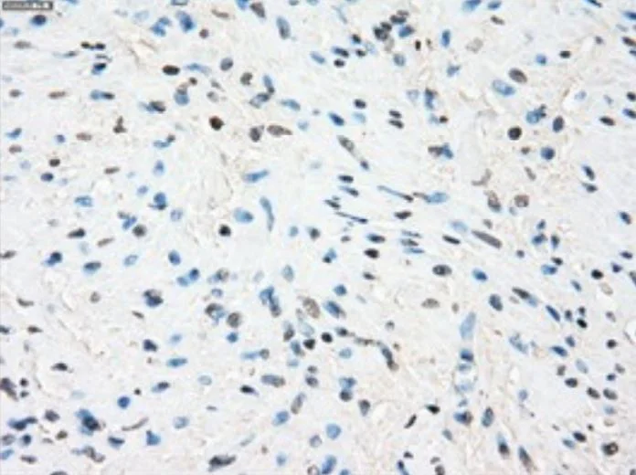 Immunohistochemistry (Formalin/PFA-fixed paraffin-embedded sections) - Anti-Tristetraprolin/TTP antibody [OTI8B5] - BSA and Azide free (AB273646)