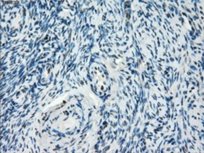 Immunohistochemistry (Formalin/PFA-fixed paraffin-embedded sections) - Anti-Tristetraprolin/TTP antibody [OTI8B5] - BSA and Azide free (AB273646), expandable thumbnail