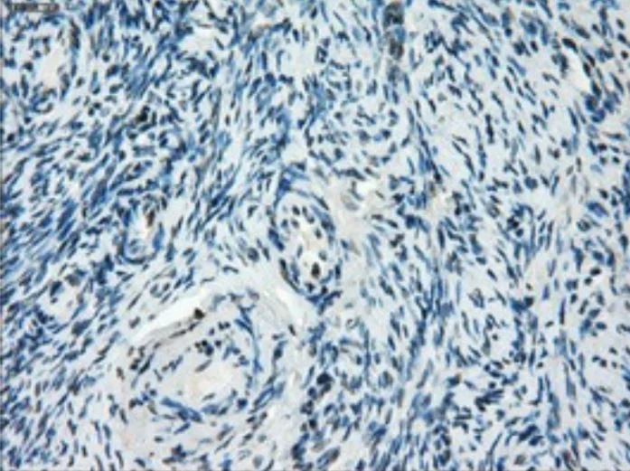 Immunohistochemistry (Formalin/PFA-fixed paraffin-embedded sections) - Anti-Tristetraprolin/TTP antibody [OTI8B5] - BSA and Azide free (AB273646)