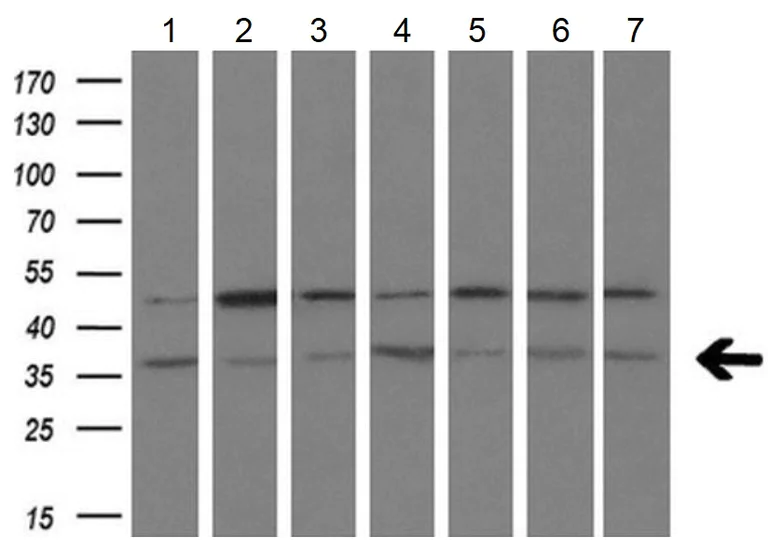 Western blot - Anti-Tristetraprolin/TTP antibody [OTI8B5] - BSA and Azide free (AB273646)