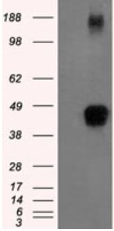 Western blot - Anti-Tristetraprolin/TTP antibody [OTI8B5] - BSA and Azide free (AB273646), expandable thumbnail