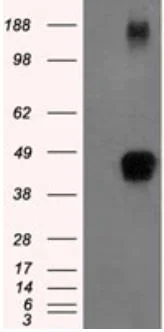 Western blot - Anti-Tristetraprolin/TTP antibody [OTI8B5] - BSA and Azide free (AB273646)