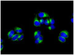 Immunocytochemistry/ Immunofluorescence - Anti-TRK fused gene antibody [EPR8765(2)(B)] (AB150428)